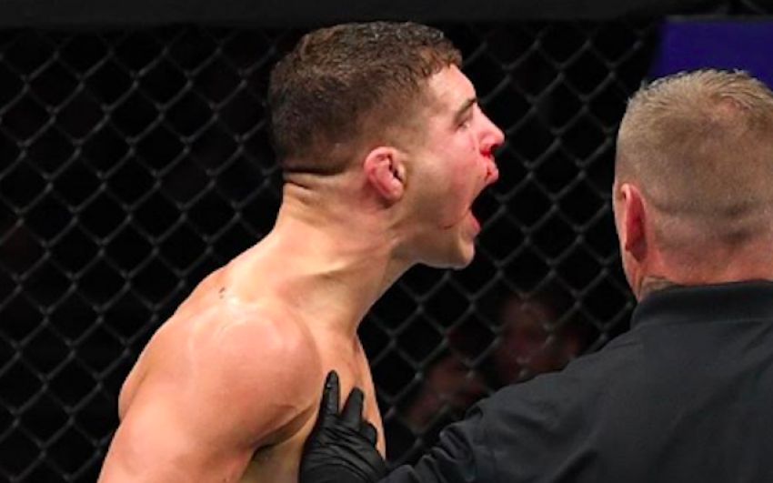 Эл Яквинта рассказал о правиле, которое UFC назвало в его честь