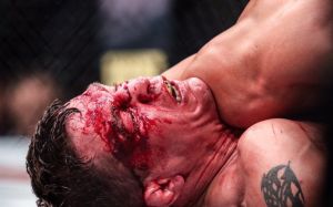 Медицинские отстранения по итогам UFC 209