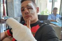 Крис Биллам-Смит: "После поражения размер гонорара за бой упал колоссально"