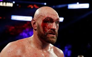 Дана Уайт: "Зачем Тайсону Фьюри подвергать себя избиению в UFC?"