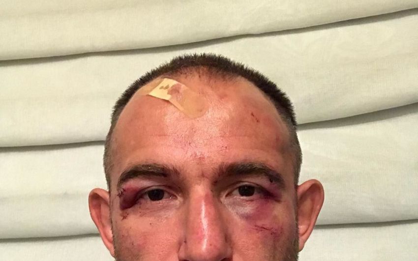 Алексей Олейник извинился перед фанатами за поражение на UFC 217