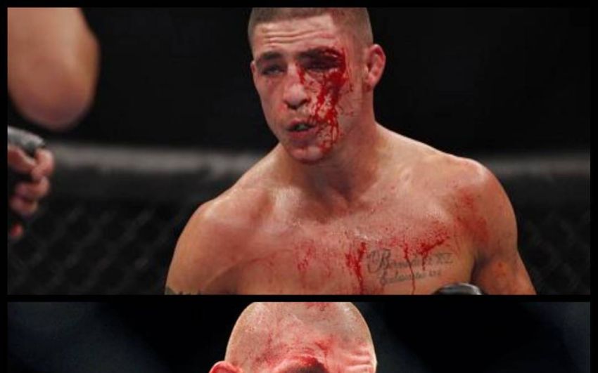 Бой Диего Санчез - Джо Лоузон в разработке на UFC 200 в Лас-Вегасе, 9 июля