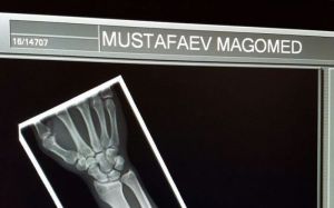 Магомед Мустафаев о своем поражении на UFC Fight Night 99