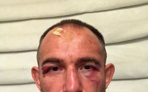 Алексей Олейник извинился перед фанатами за поражение на UFC 217
