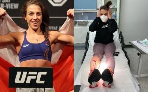 Йоанна Енджейчик показала жуткое рассечение на ноге: "Значит, вы хотите быть бойцами?"