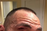 Андрей Руденко остановил Майка Молло