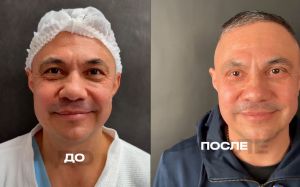 Костя Цзю сделал пластическую операцию