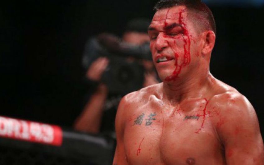 Эммануэль Санчес снялся с Bellator 166