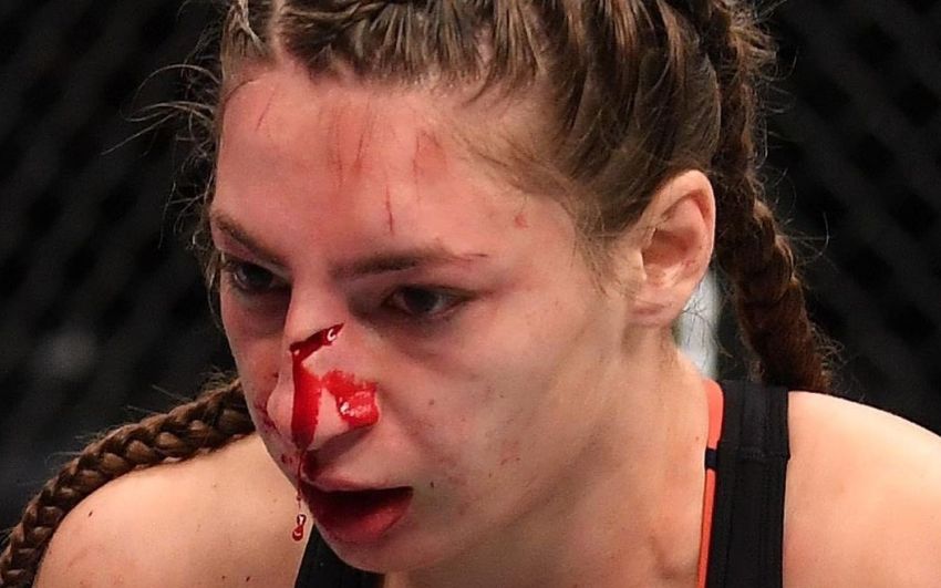 UFC предлагали Лиане Джоджуа сделать пластическую операцию после поражения Мэверик