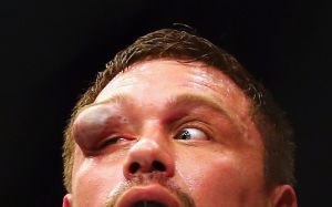 Мэтт Митрион переходит в Bellator