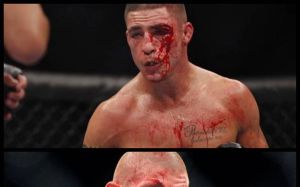 Бой Диего Санчез - Джо Лоузон в разработке на UFC 200 в Лас-Вегасе, 9 июля