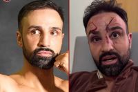 Пол Малиньяджи: "Новые достижения смягчат окончательное завершение карьеры"