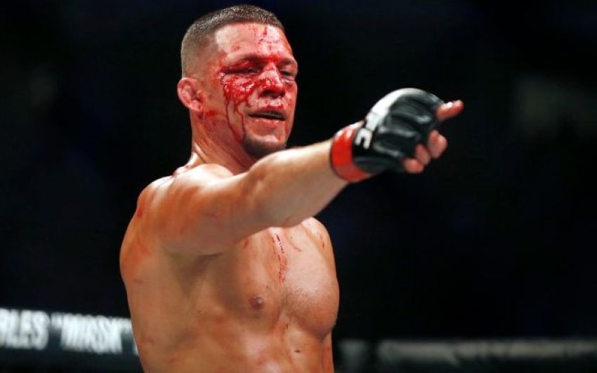 Нейт Диас высмеял топов легкого и полусреднего дивизионов UFC