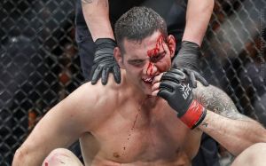 Крис Вайдман выбывает на 2 месяца + другие медицинские отстранения после UFC 205