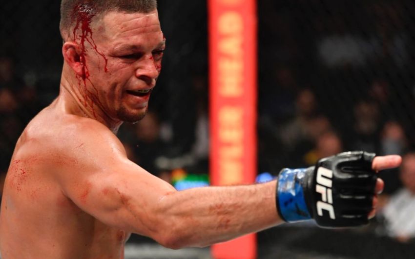 Нейт Диас не исключает, что подпишет новый контракт с UFC, если победит Хамзата Чимаева