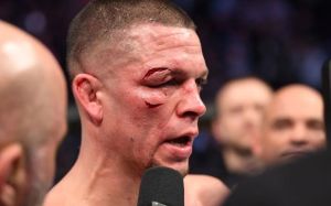 Медицинские отстранения участников турнира UFC 244: Хорхе Масвидаль - Нейт Диас