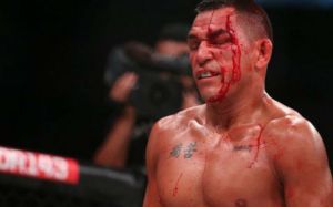 Эммануэль Санчес снялся с Bellator 166