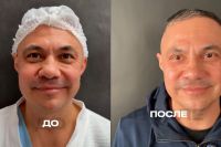 Костя Цзю сделал пластическую операцию