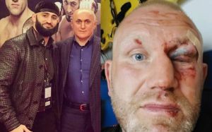 Сергей Харитонов - об оплате лечения со стороны Яндиева: "Мне никто и ничего не компенсировал"
