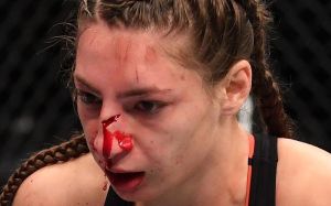 UFC предлагали Лиане Джоджуа сделать пластическую операцию после поражения Мэверик