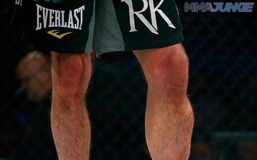 Кадр дня: Голень Рори МакДональда после турнира Bellator 192