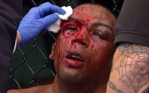 Медицинские отстранения после турнира UFC Fight Night 128