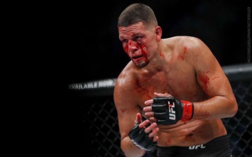 Нэйт Диас: Я не отвечу на звонок UFC меньше, чем за 20 миллионов долларов